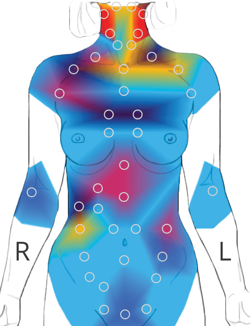 Thermal body imaging graphic showing heat patterns for thermography screening in Southlake TX